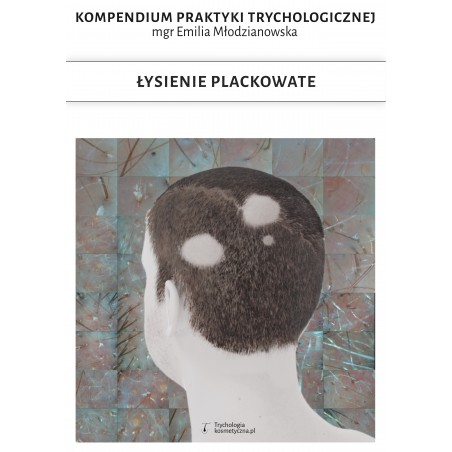 E-book Łysienie plackowate