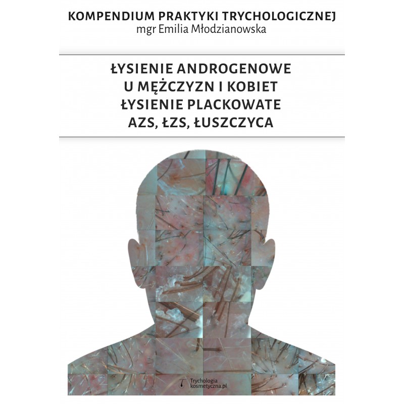 E-book Łysienie androgenowe u kobiet & mężczyzn, łysienie plackowate, AZS, ŁZS, łuszczyca