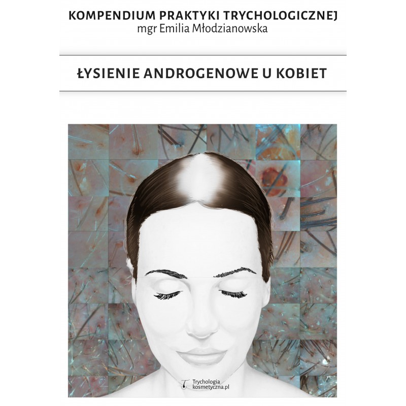 E-book łysienie androgenowe u kobiet