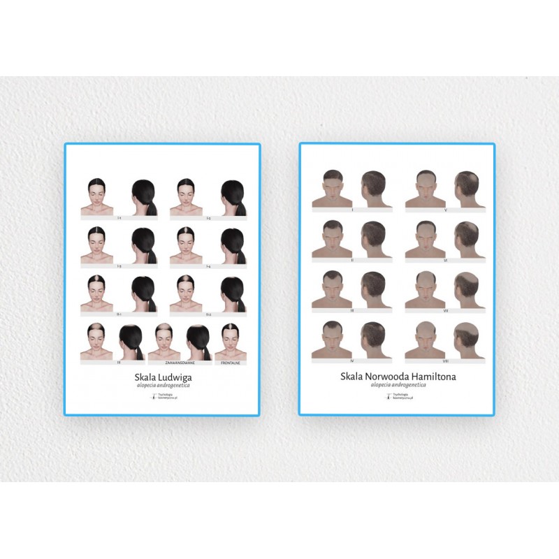 Pakiet 2 plakatów 60x80 łysienie androgenowe u kobiet i mężczyzn