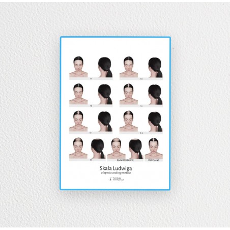 Plakat 60x80cm łysienie androgenowe u kobiet